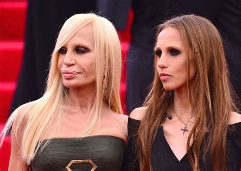 donatella versace malattia|donatella versace health.